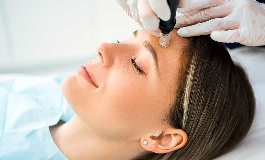 How Microneedling works